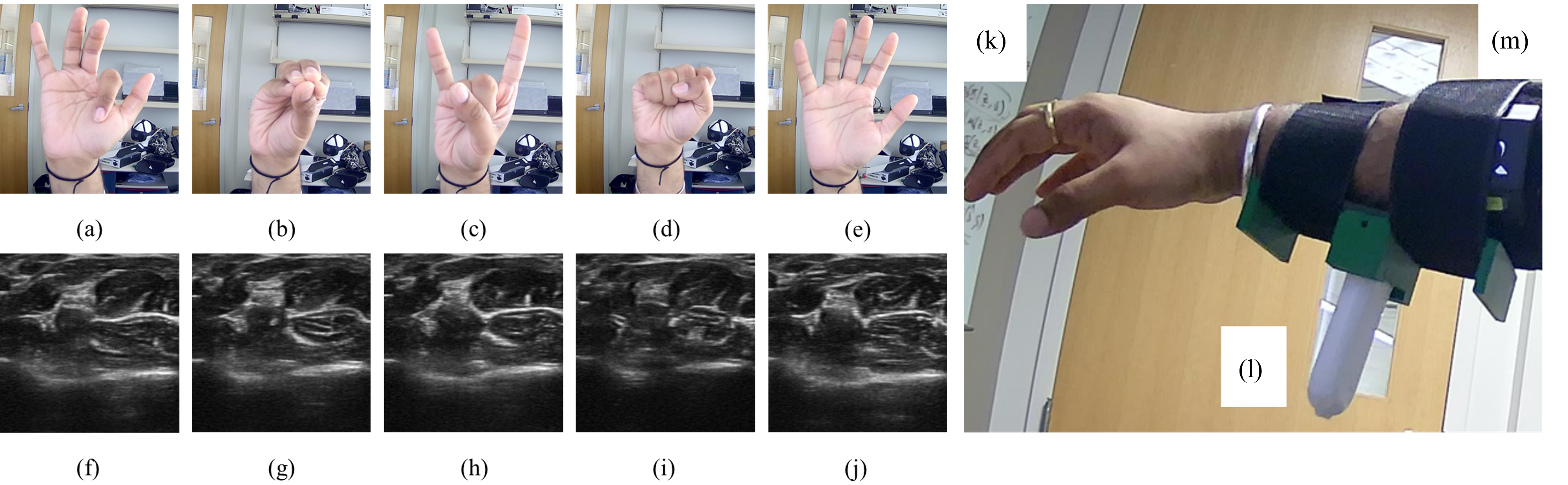 Hand gestures and corresponding forearm ultrasound images